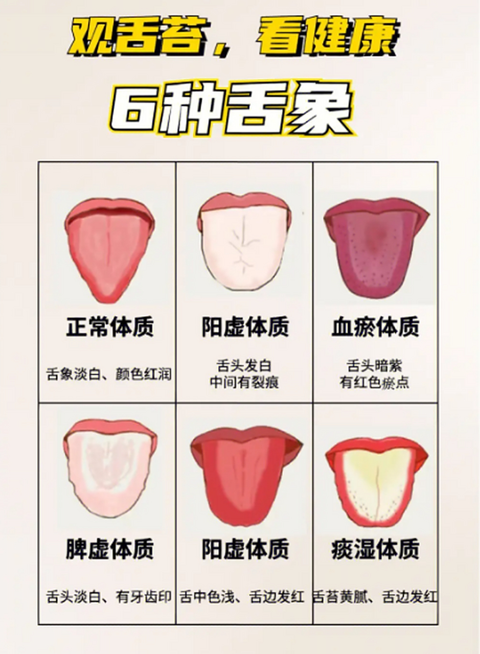 从舌苔看健康  肝不好的朋友  赶紧拿出镜子来照照  看你是哪种舌苔?