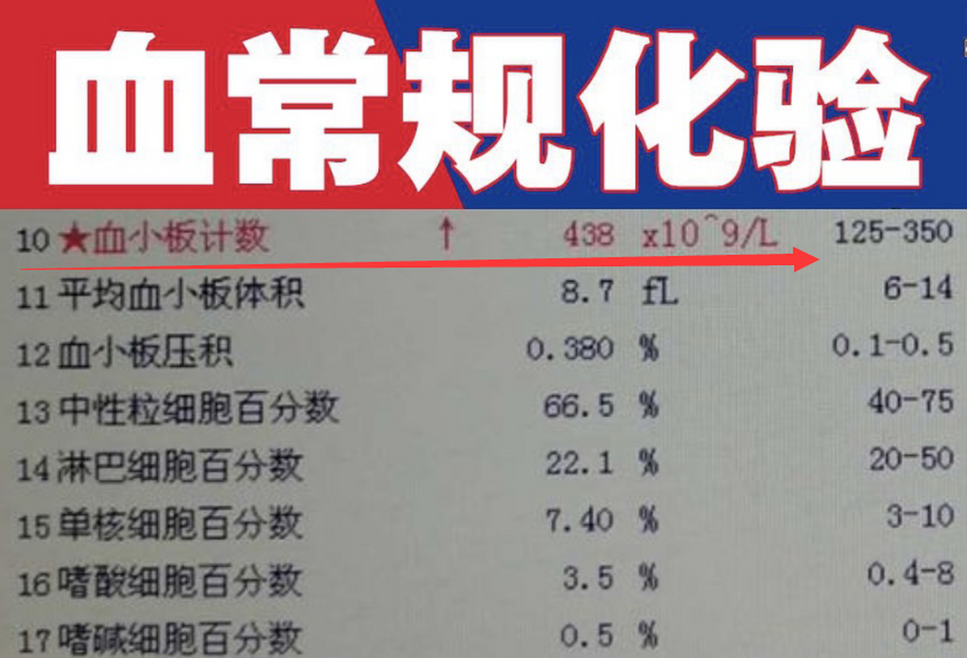 患者提問: 醫生您好,我體檢檢查時血小板計數350,當時醫生說可以不