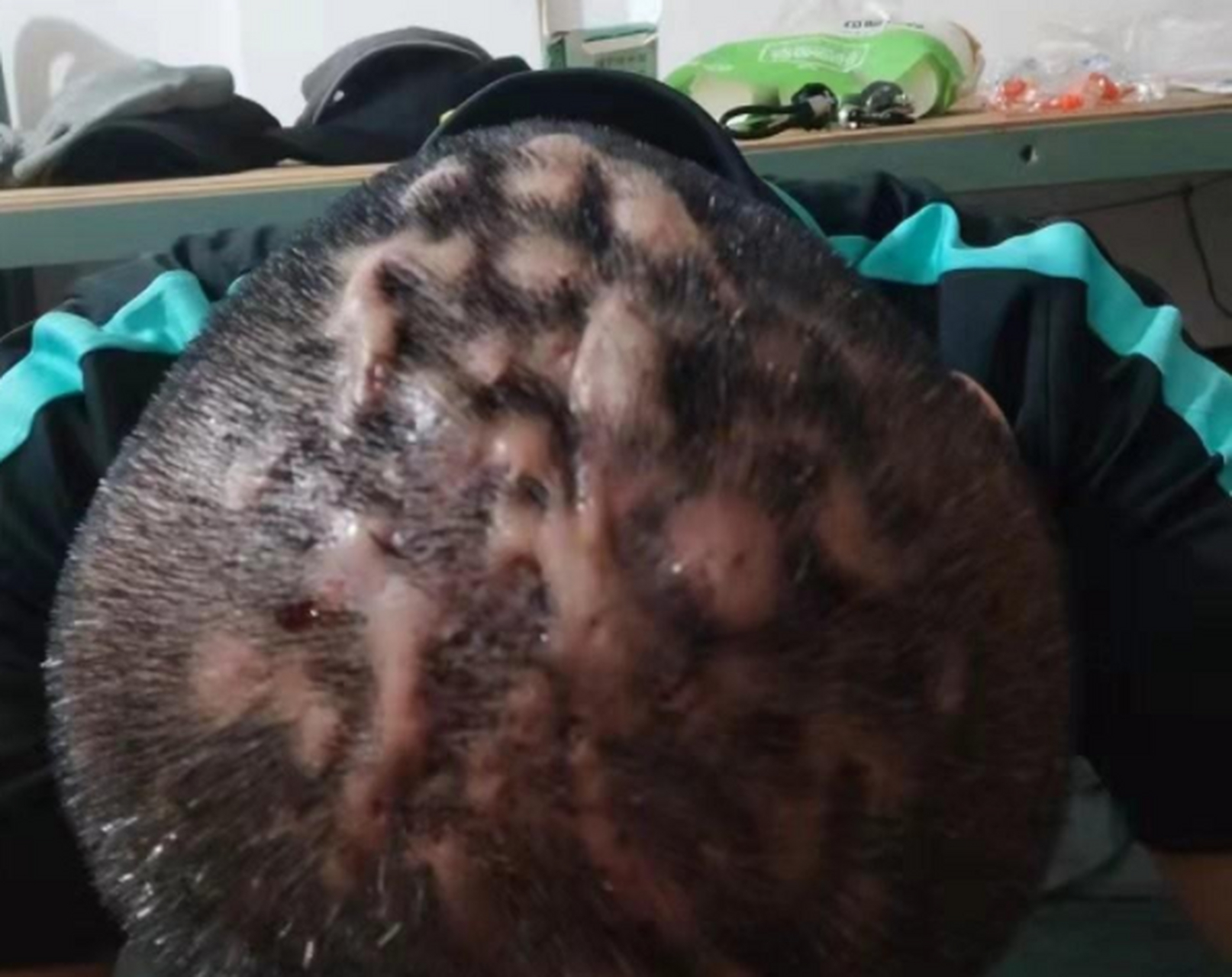 满头大包下去得差不多了,这次受益中医,让他看到希望!