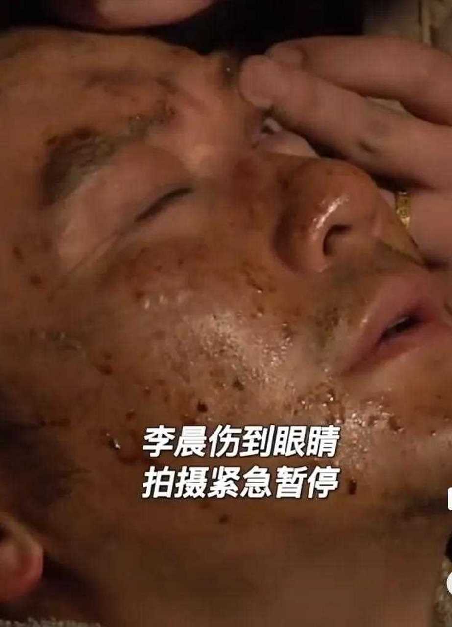 吴京抢着帮李晨讲眼睛受伤经历.