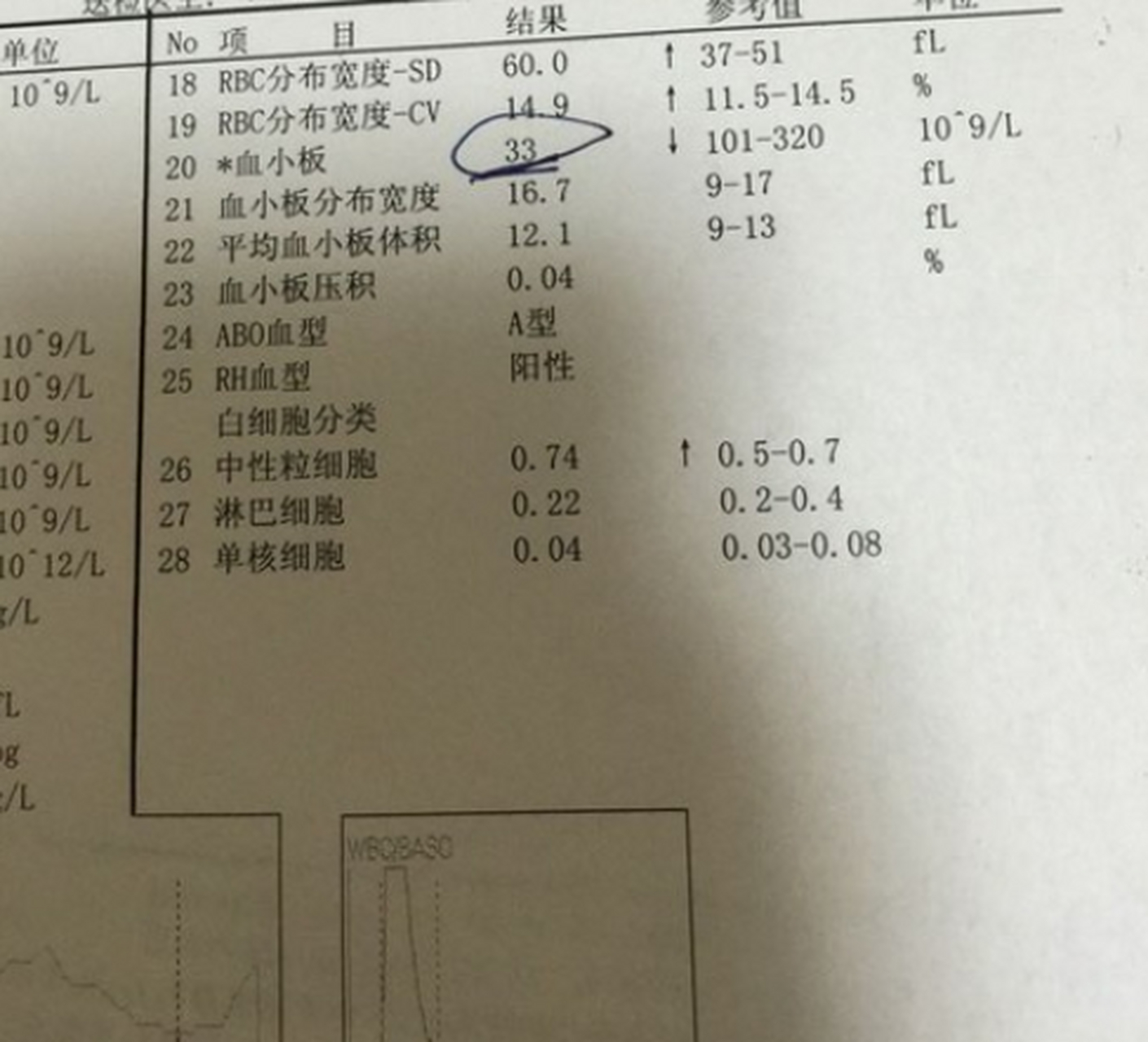 有位患者问我"血小板低一点点要紧吗"?现在血小板计数是92.