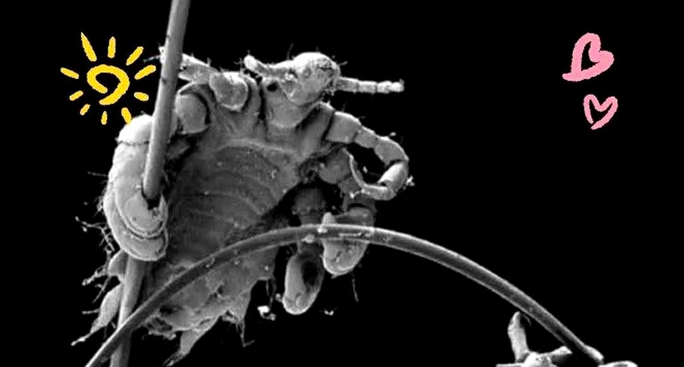 经过放大,虱子的形态变得更加清晰可见.