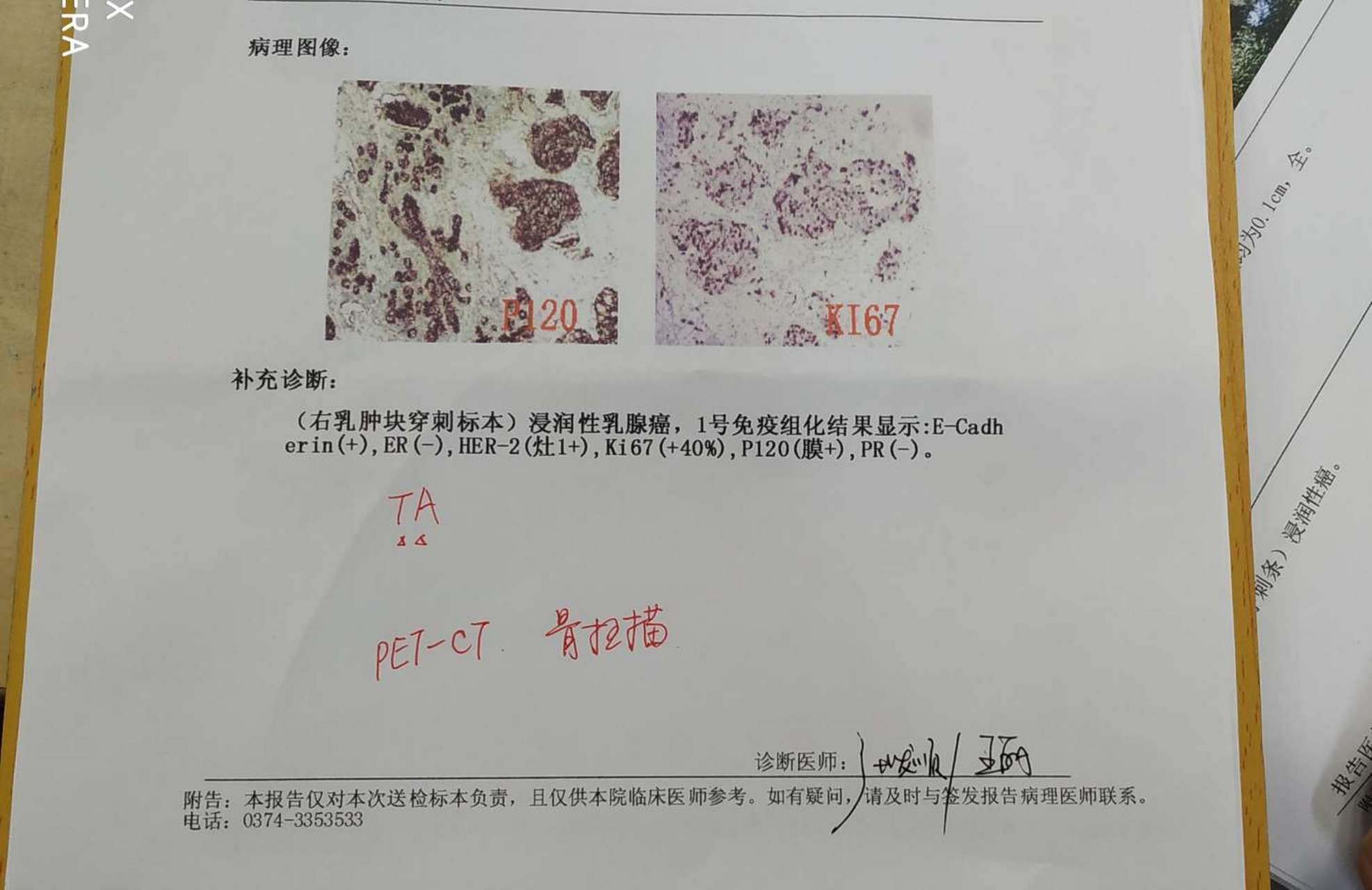 三阴性乳腺癌不可怕,80%可治疗[鲜花]  今天查房,听到两个病人在聊天