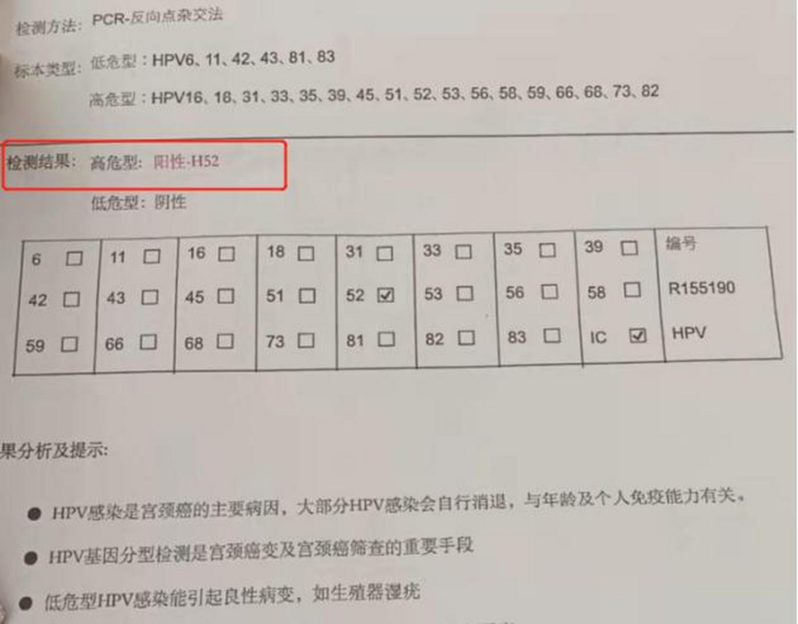 近来因白带量多且发黄,腰膝酸软,外y少量出血,查出hpv52阳性,tct:非