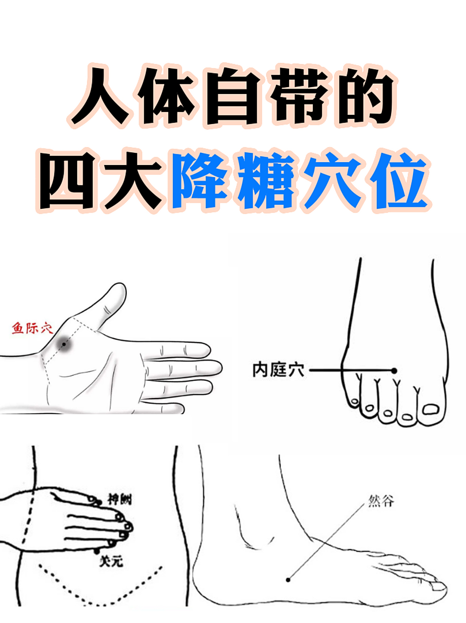 鱼际穴 鱼际穴属手太阴肺经的荥穴,位于第1掌骨中点桡侧,赤白肉际处