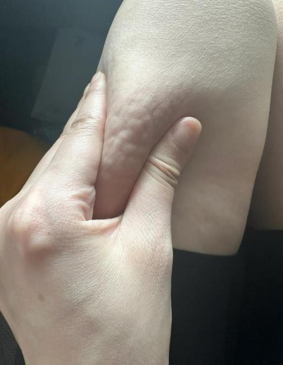 大腿上一抓一大把这样的肉,但是我不胖啊,身高168体重才100斤,大腿和