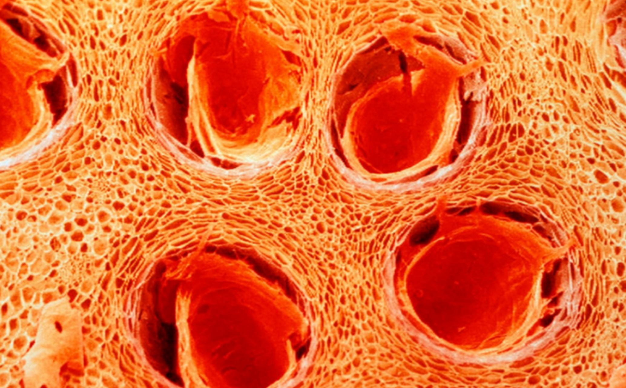 橘子皮在显微镜下的样子!