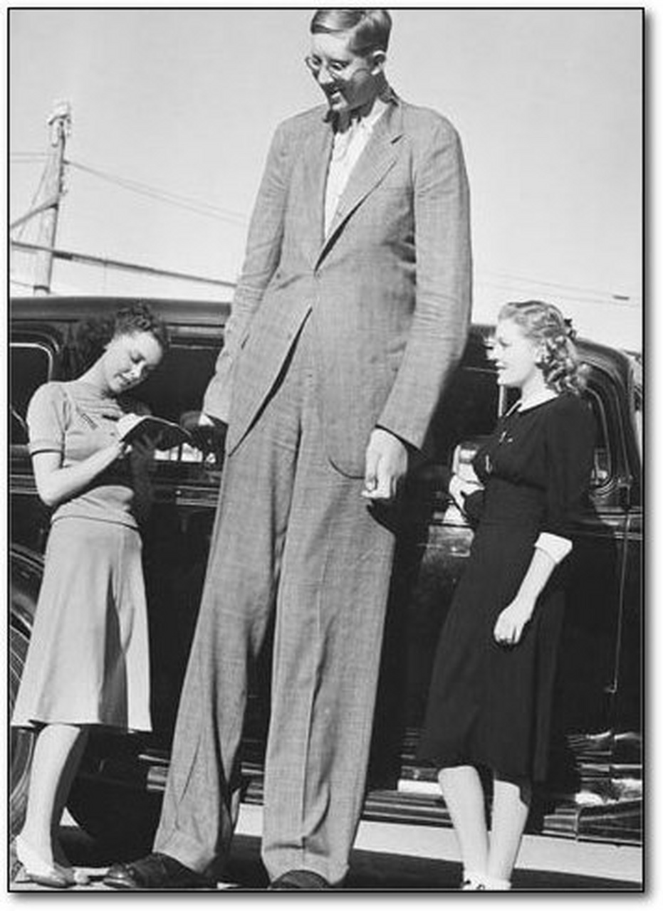 史上身高最高272公分的巨人症男子罗伯特·瓦德罗 (robert wadlow) 于
