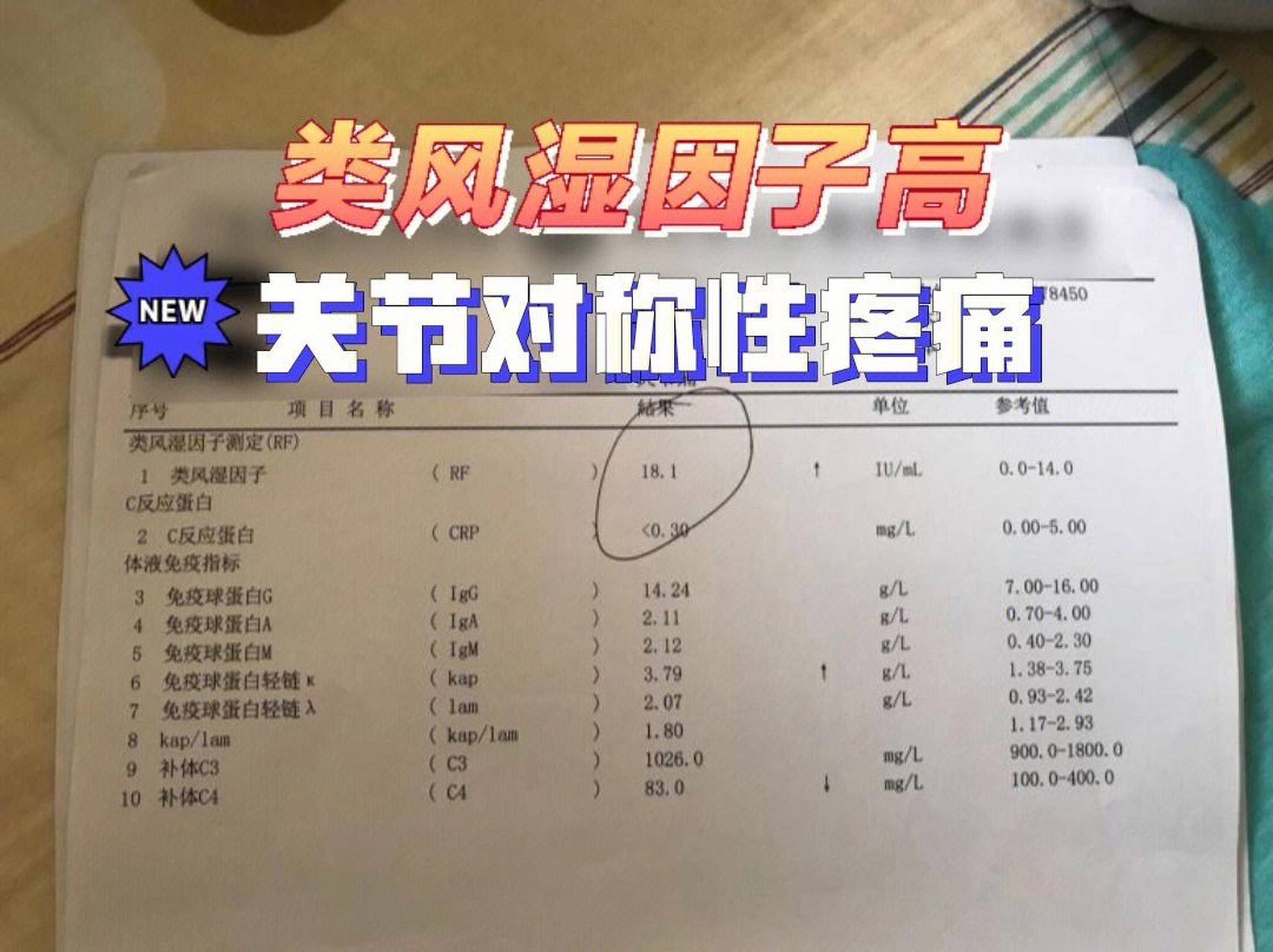 风湿五项是指血液检查时的五个指标:类风湿因子(rf),抗环瓜氨酸肽抗体