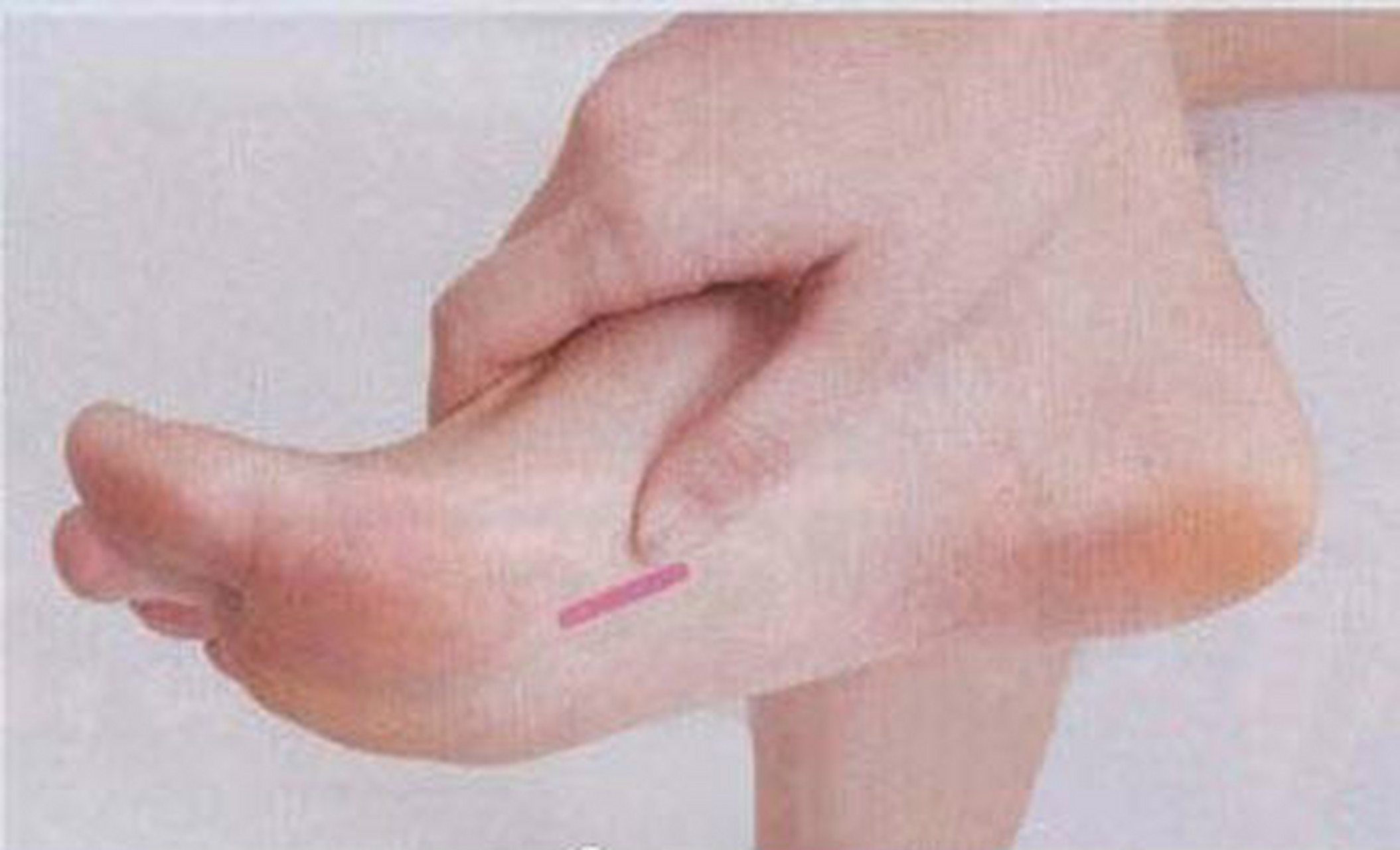 揉地筋 解肝病 将脚底面向自己,把足趾向脚背方向翻起,就会发现一条硬