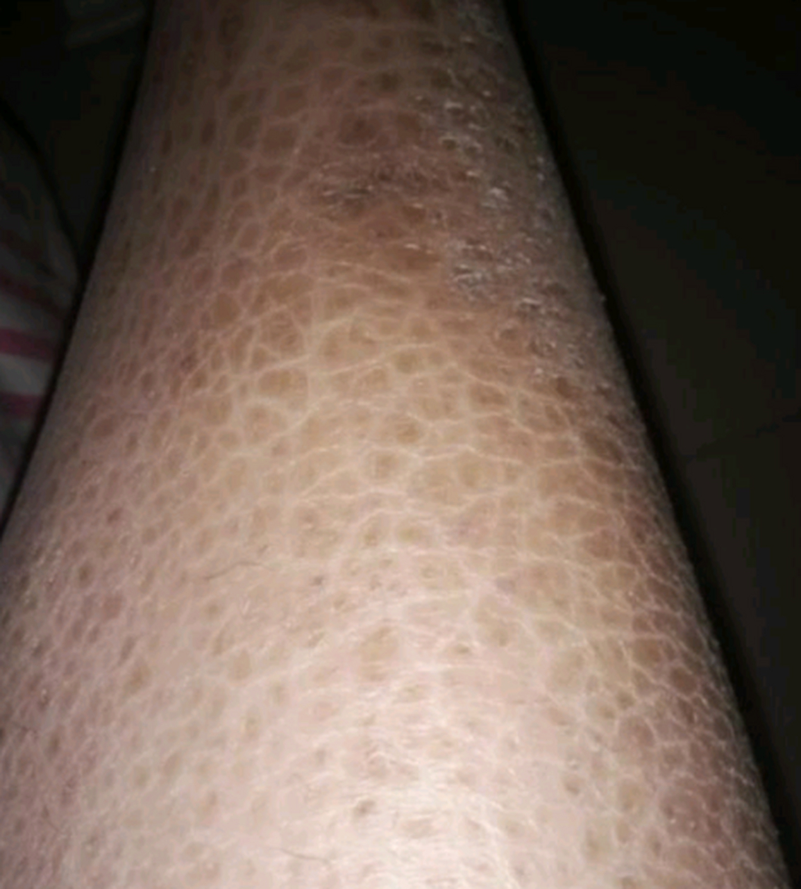 大家看一下这个腿是不是有什么皮肤病?