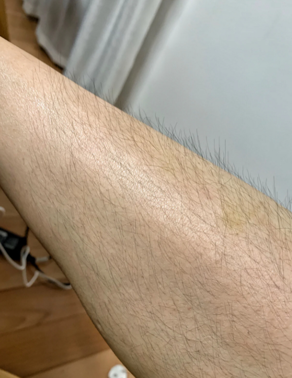 腿部汗毛的存在可能会给我们带来不便和烦恼,尤其是在夏天穿短裙或者