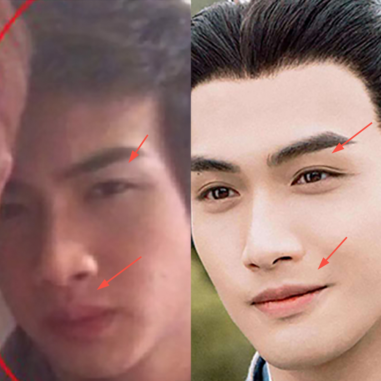 理性讨论:张彬彬到底整容了没?