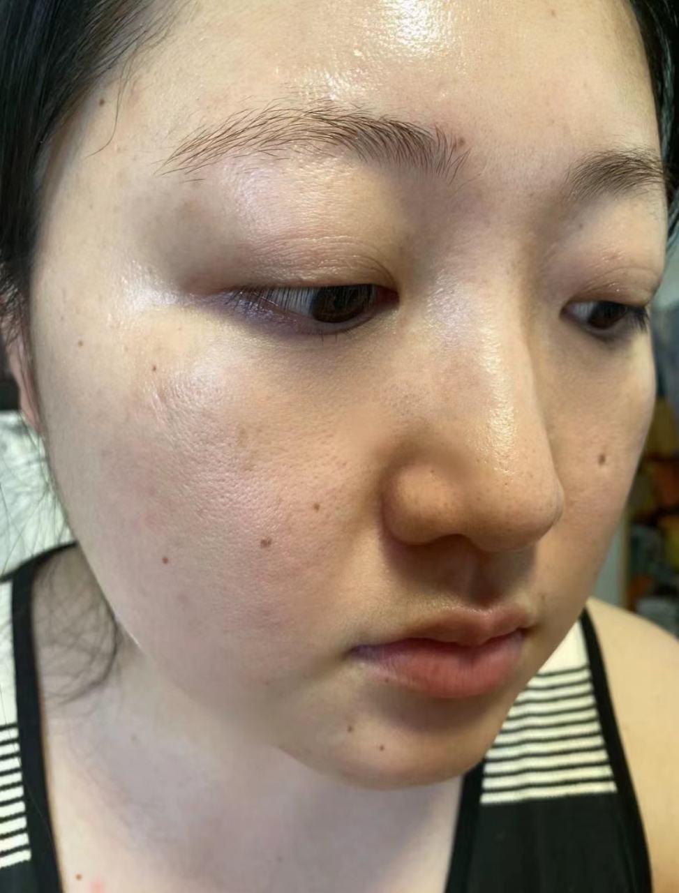 脸部黑色素沉着是很多人的困扰,但通过一些简单的方法,我们可以帮助