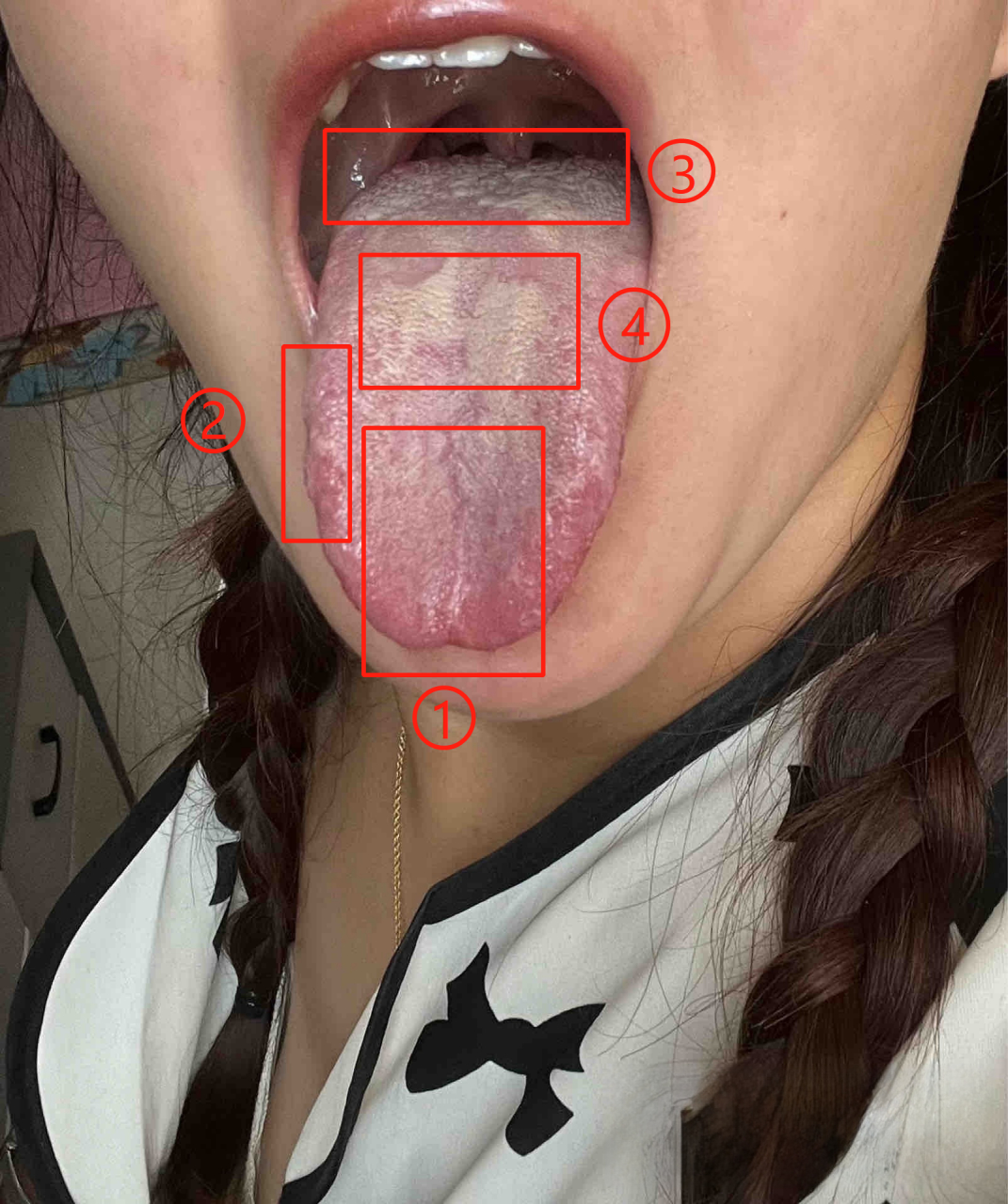 肾阴虚的舌(肾阴虚的舌像)