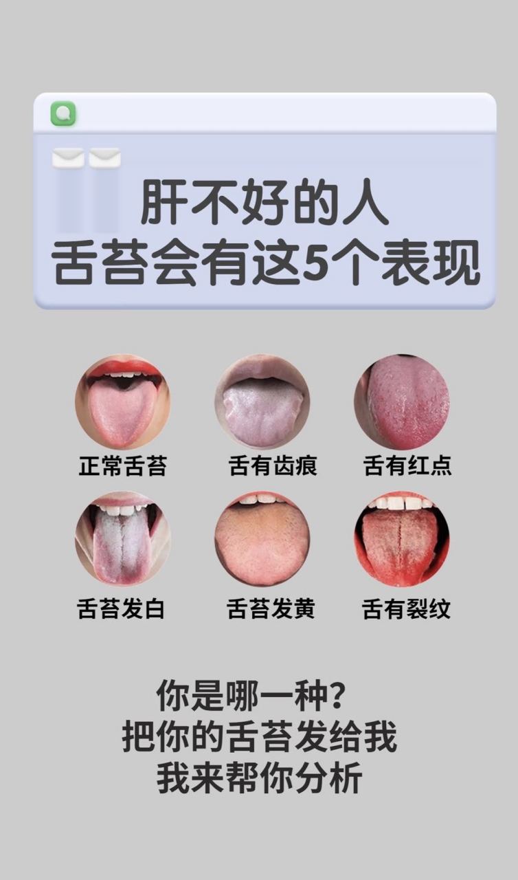 肝不好舌苔会有这5个表现,看看你是哪一种?#肝病# #肝气郁结# #中医