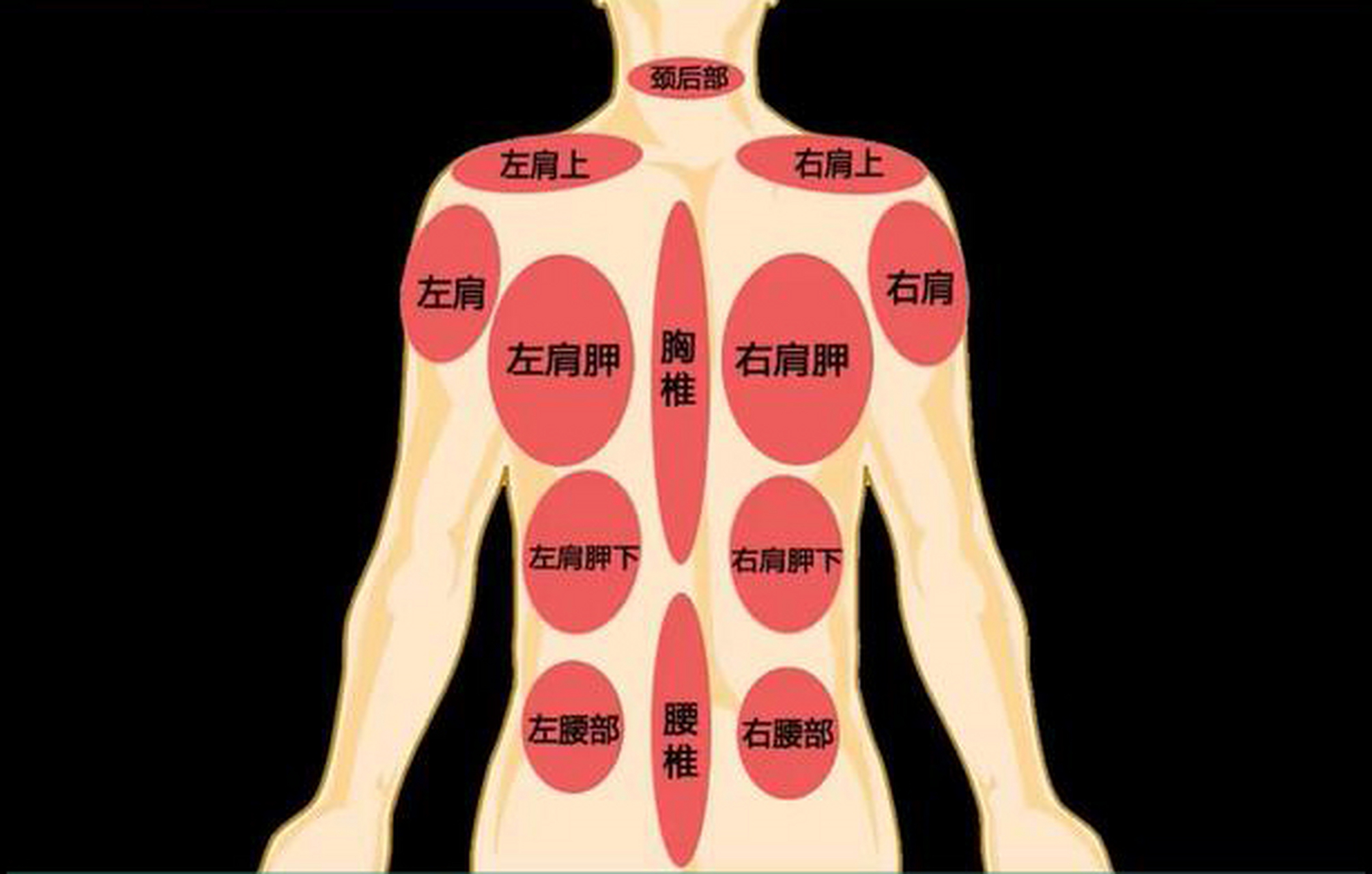 一秒钟告诉你,腰背部不同位置疼痛代表什么 1.