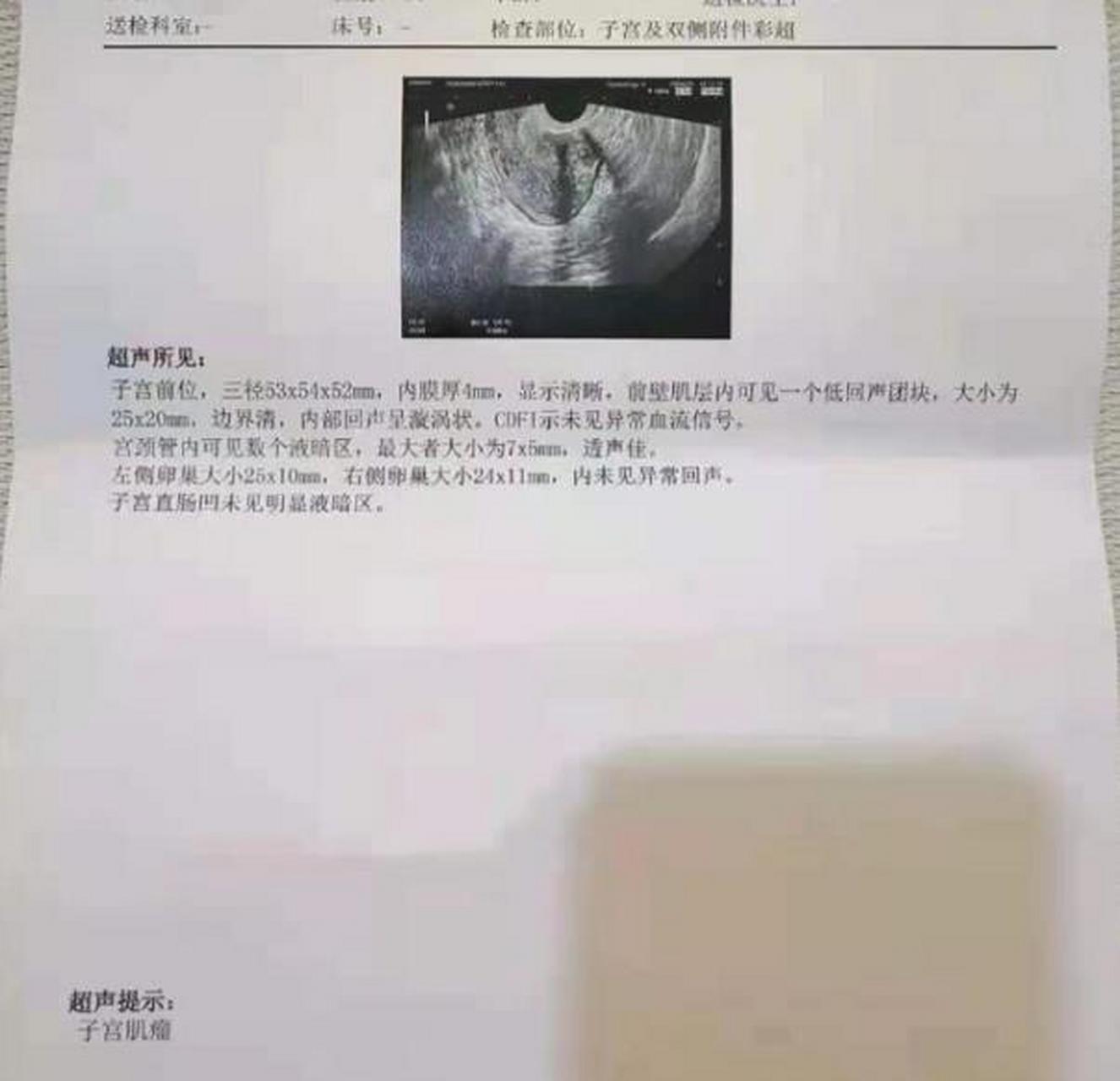 5公分以下的小肌瘤不用管?提醒:后果你可能承受不了!