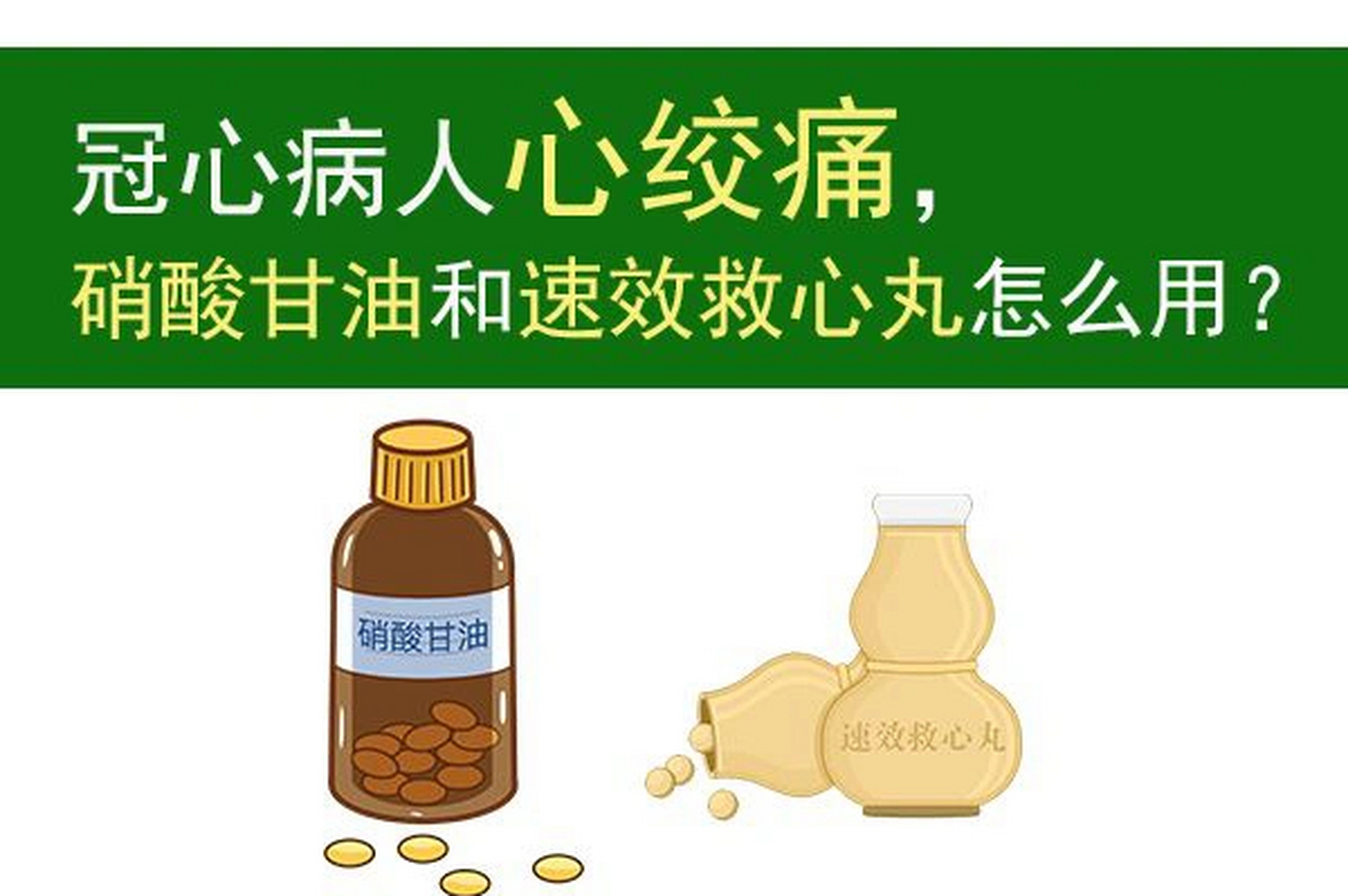 冠心病心绞痛,硝酸甘油和速效救心丸怎么用  这两种药都是用于同一个