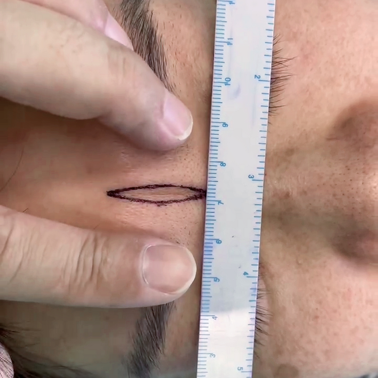 难道这么深的川字纹,就不是永远的吗?