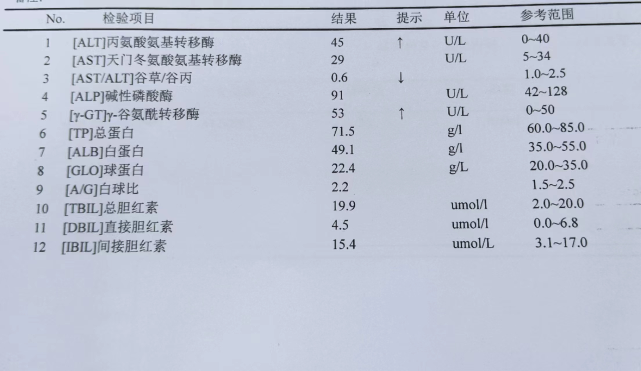 首先是化验肝功能