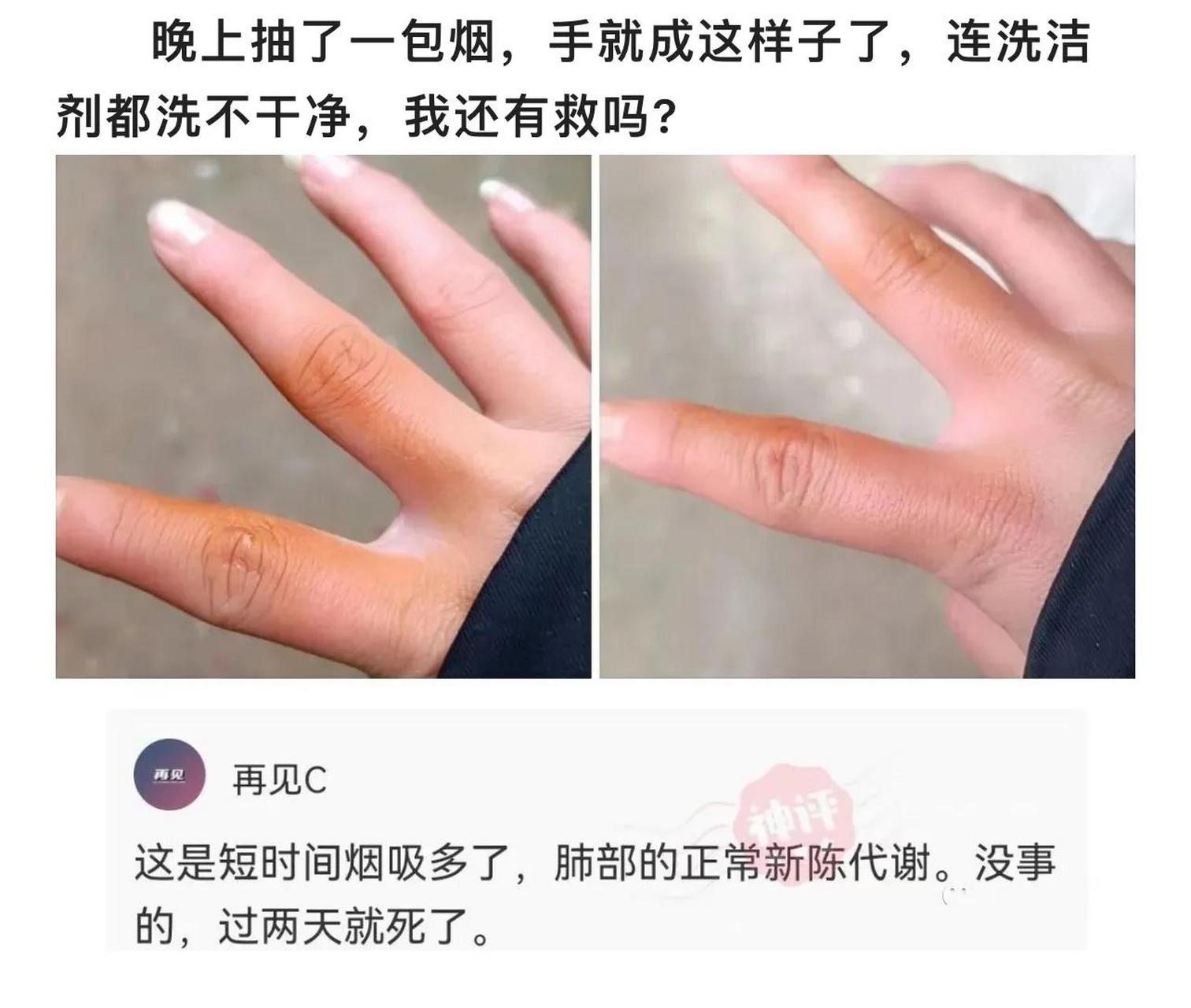 你这烟熏手,是不是都没洗过啊