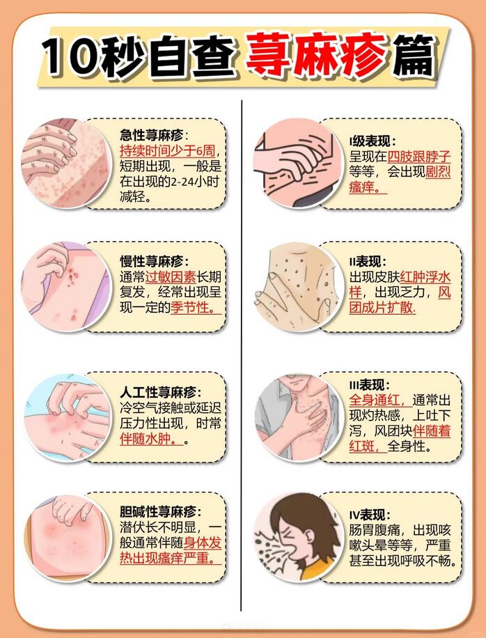 荨麻疹的类型图片