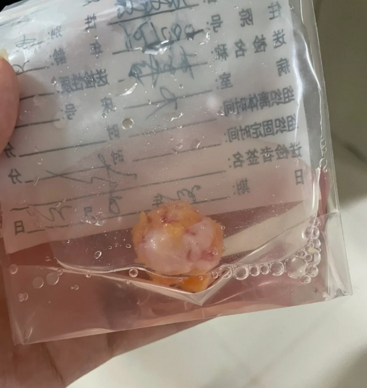 切出来的乳腺结节图片图片