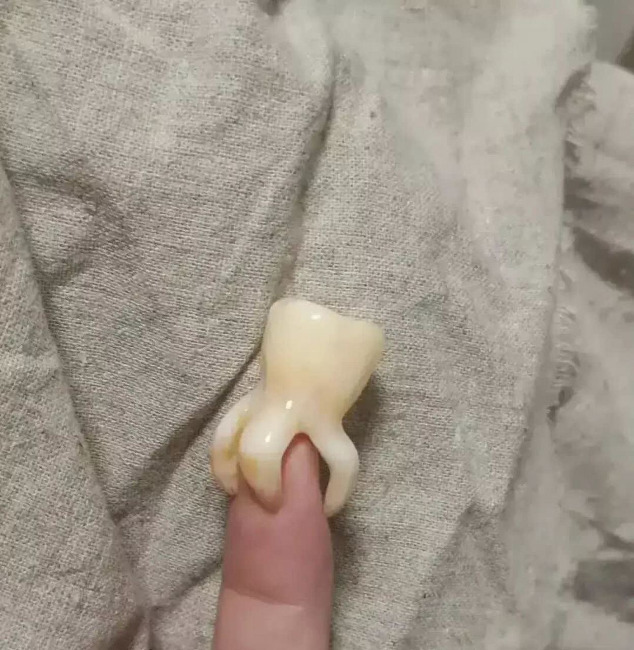 花了1000块钱拔牙,感觉被骗了[嘘][滑稽]