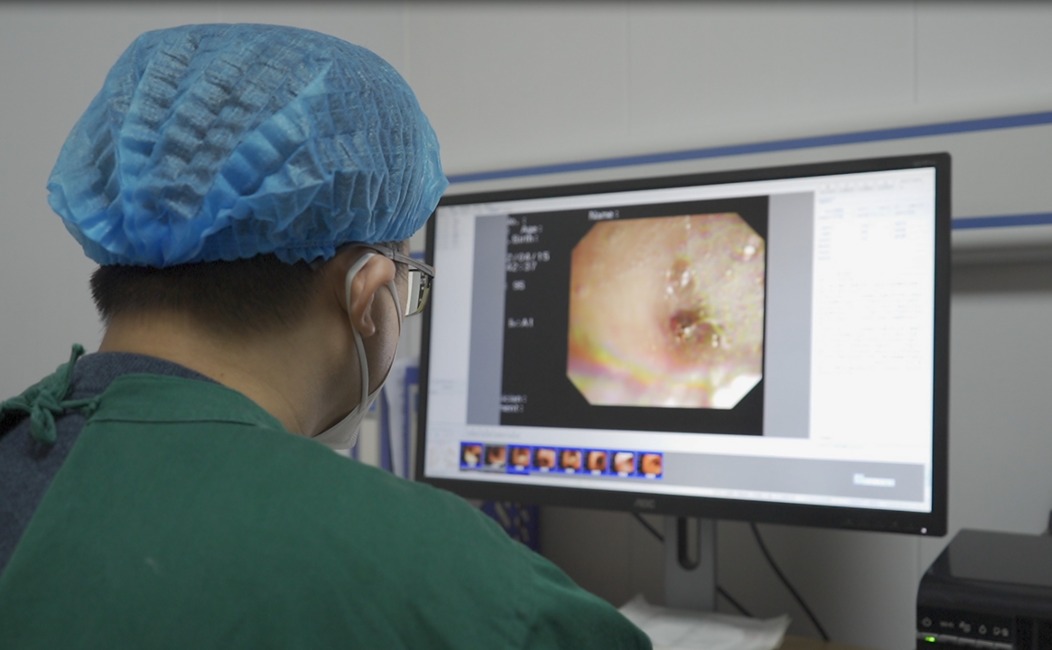 [赞同]成都市第三人民医院呼吸科吴迪医生公布,肺部ct检查报告的8个"