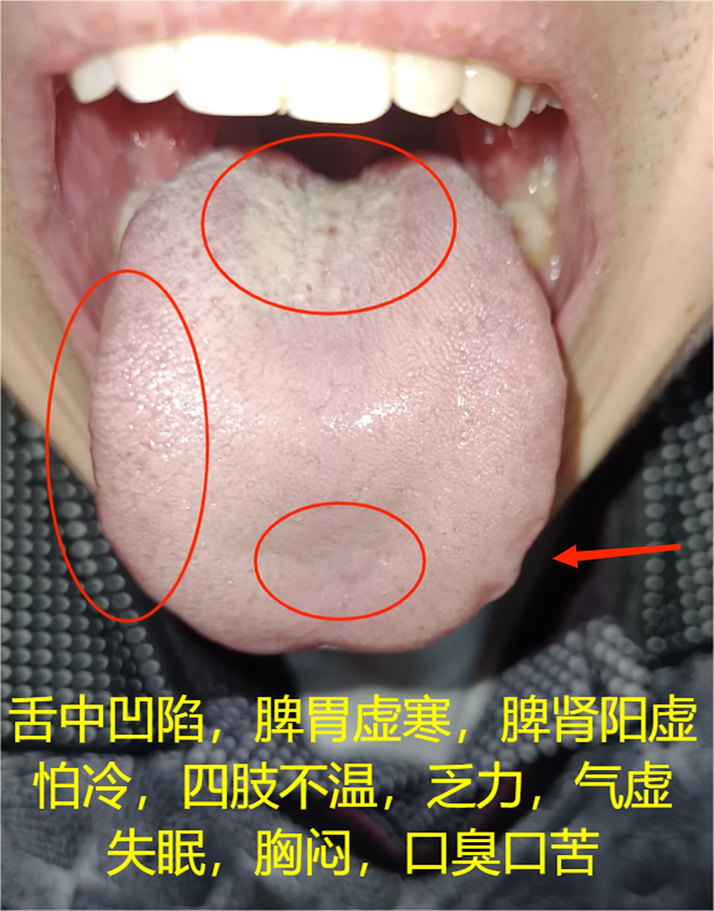 健康问题舌象知道,舌诊分析图,可以看一下#健康养生# #舌象