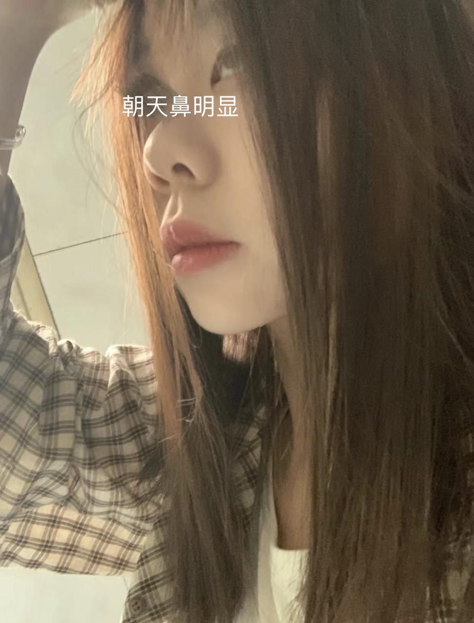 朝天鼻就是鼻孔露出比较多,鼻尖朝上翘起,鼻梁较短,也称为短鼻.