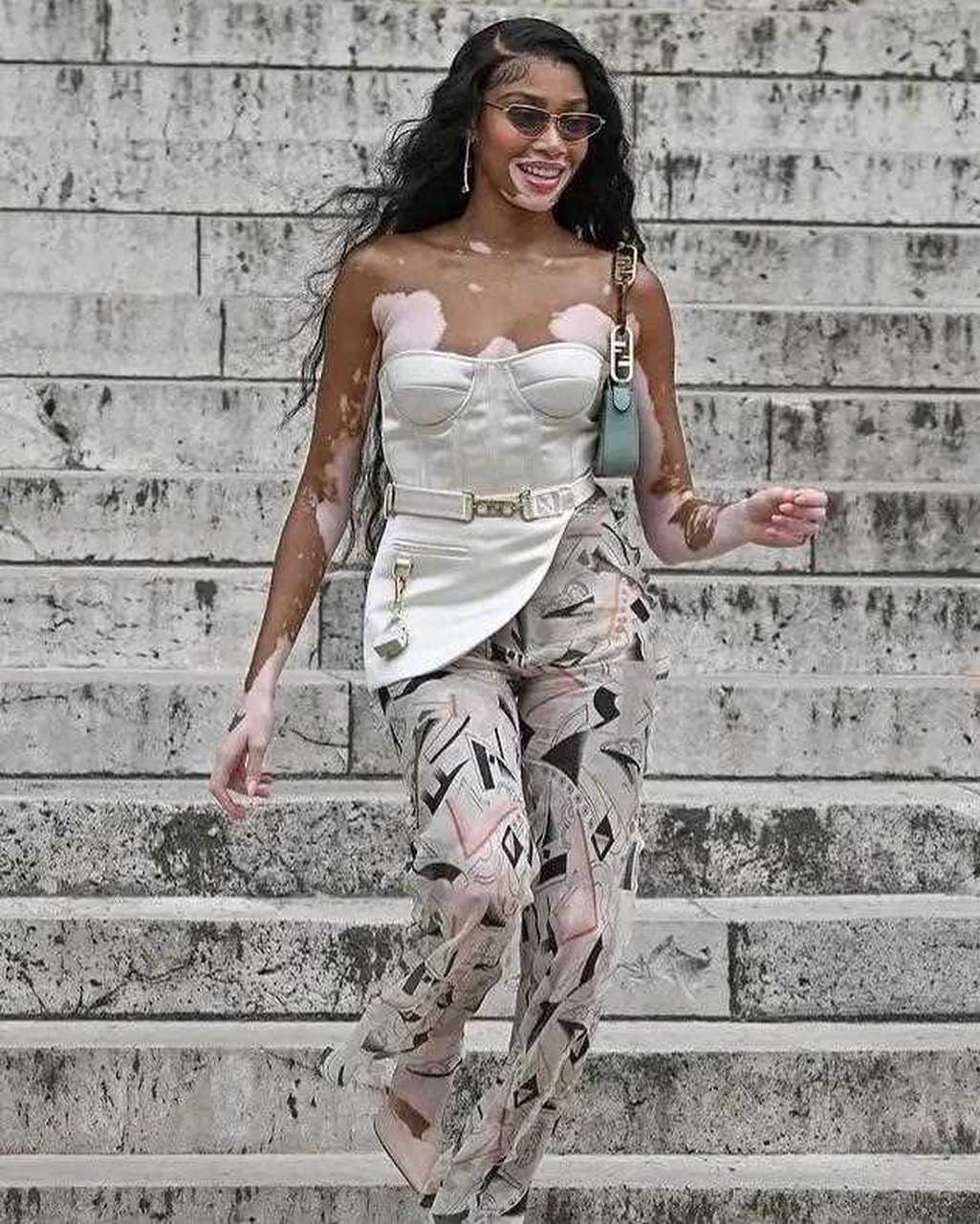 "奶牛超模"温妮哈洛穿衣有个性!