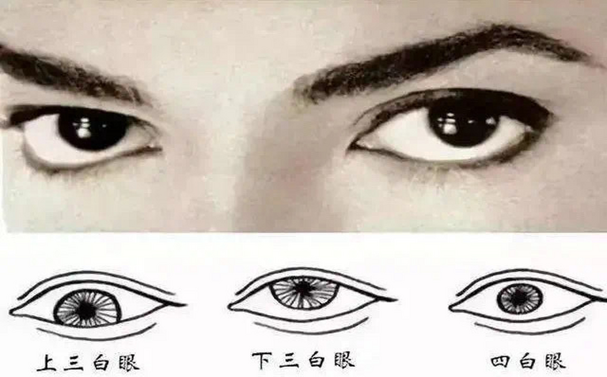 三白眼:    三白眼是瞳仁很靠上或者很靠下,看上去眼睛三面的眼白很多