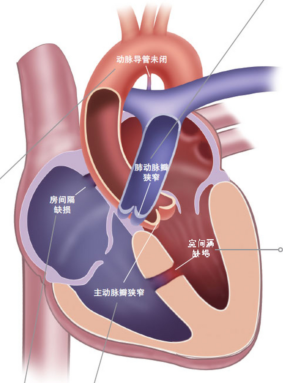 心脏图示意图 结构图图片