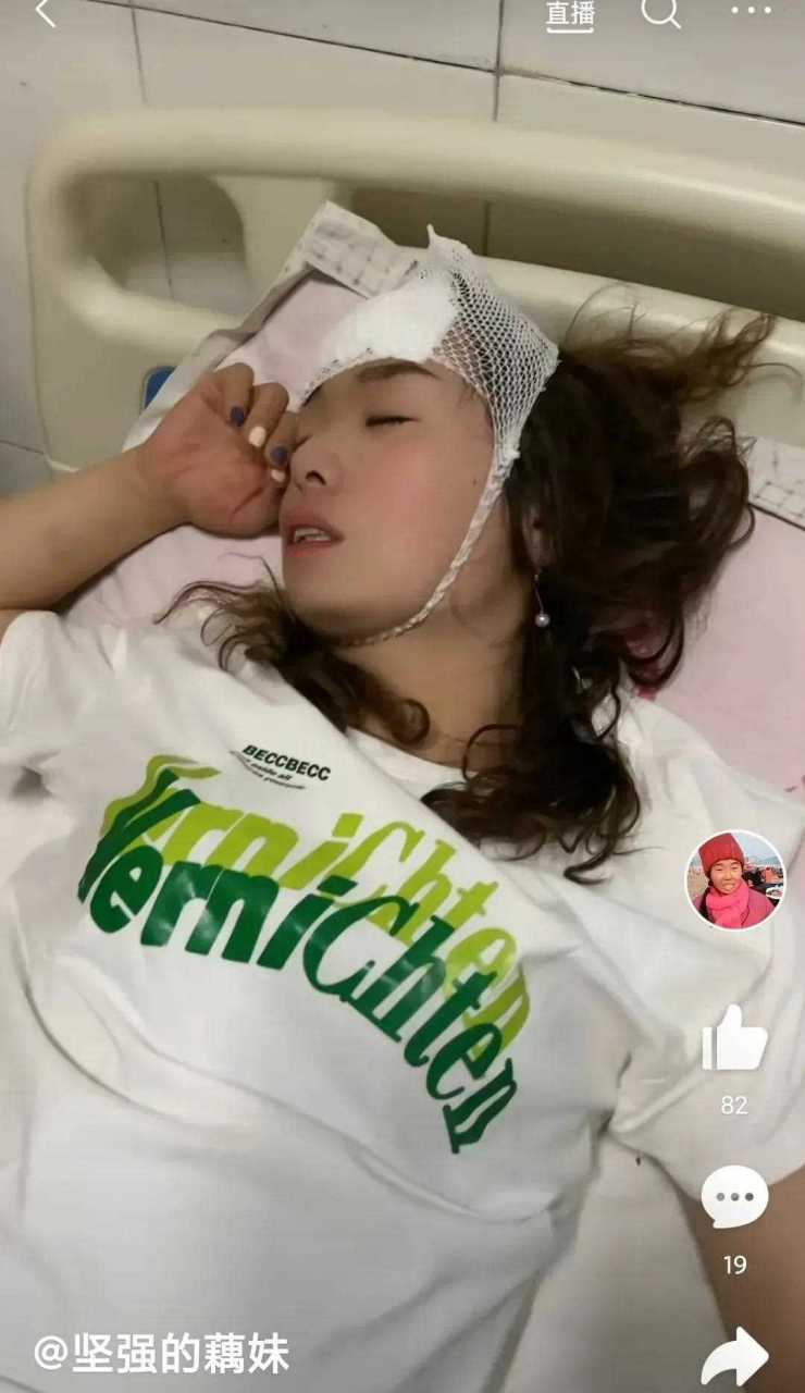 藕妹又一次被打的头破血流.[爱你] 作为一个单身女人的藕妹太难了.[?