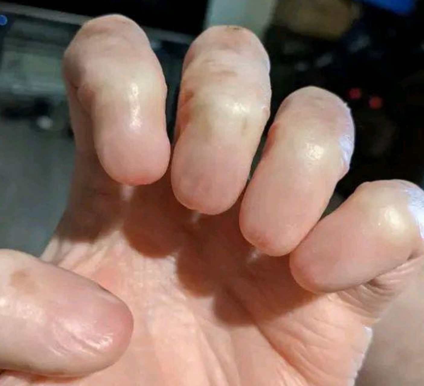 天生没有指甲,看着就疼