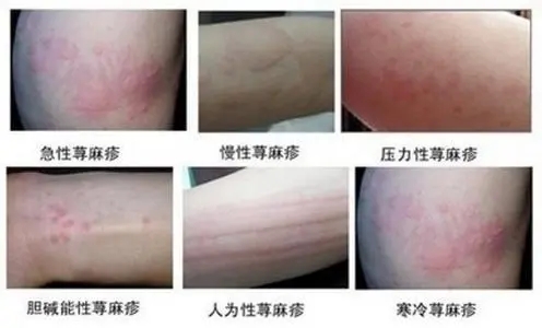關(guān)于空軍總醫(yī)院、全國服務(wù)-收費透明一直在用的黃牛掛號，推薦大家收藏備用的信息