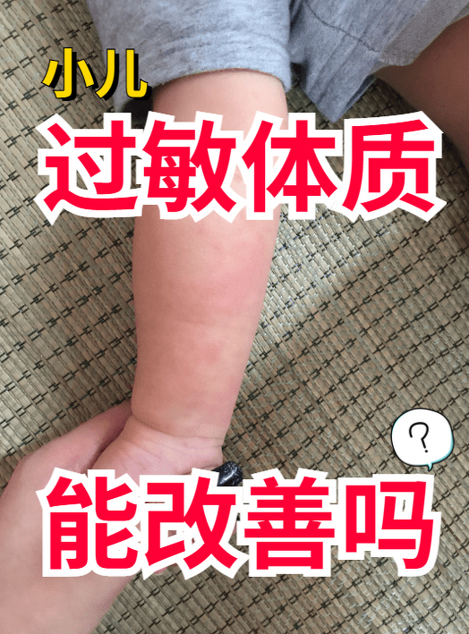 【患者提问】 我家小孩从出生就特别容易过敏,皮肤比较敏感,有什么好
