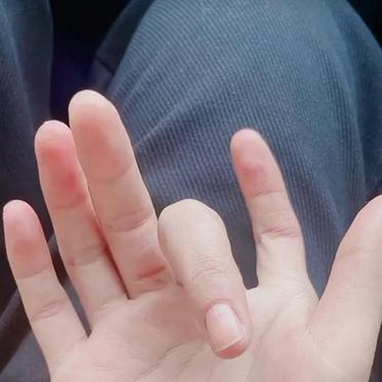 原来六个手指头也这么好看呀,就是不好买手套吧?