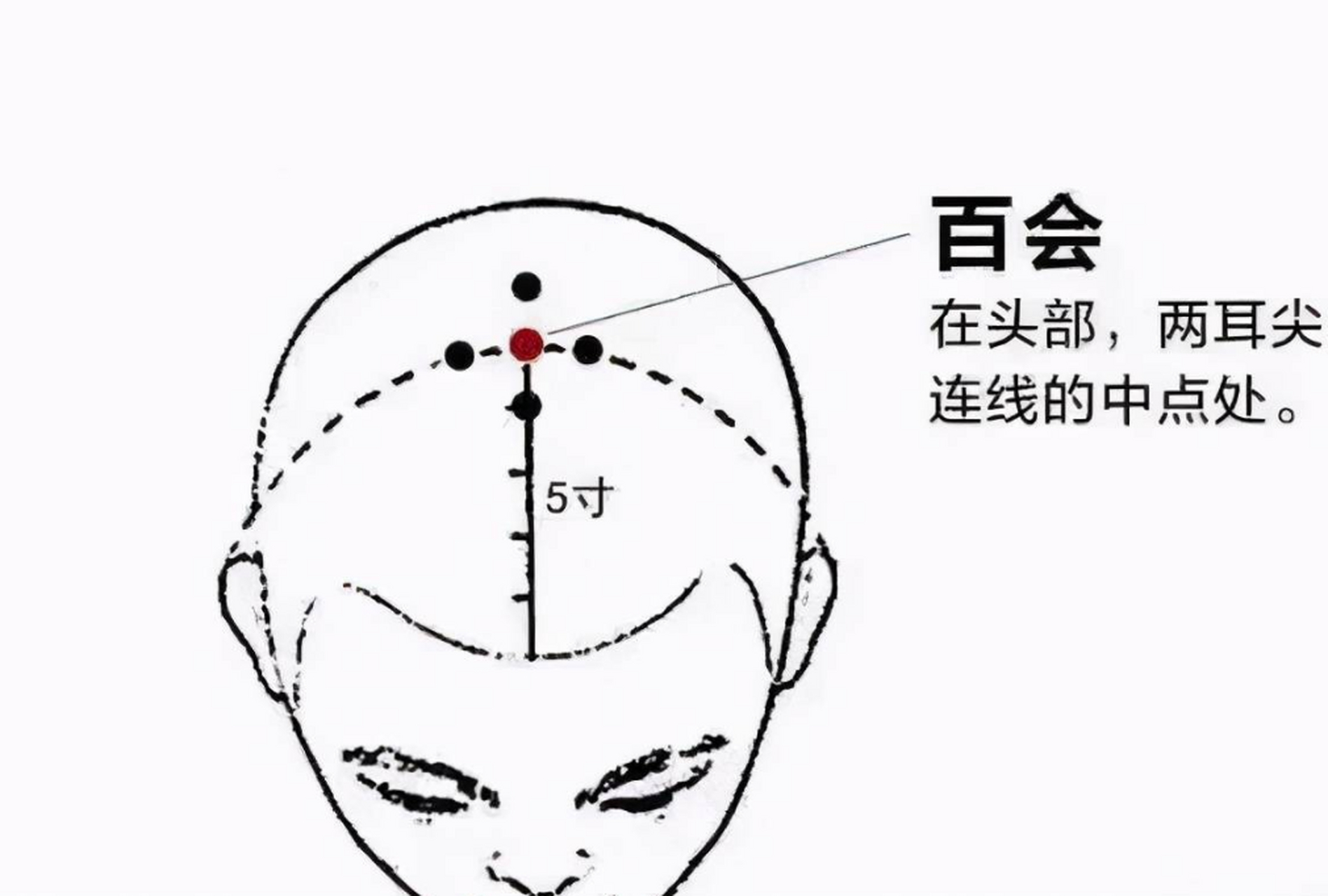 脑供血不足按摩方法图图片