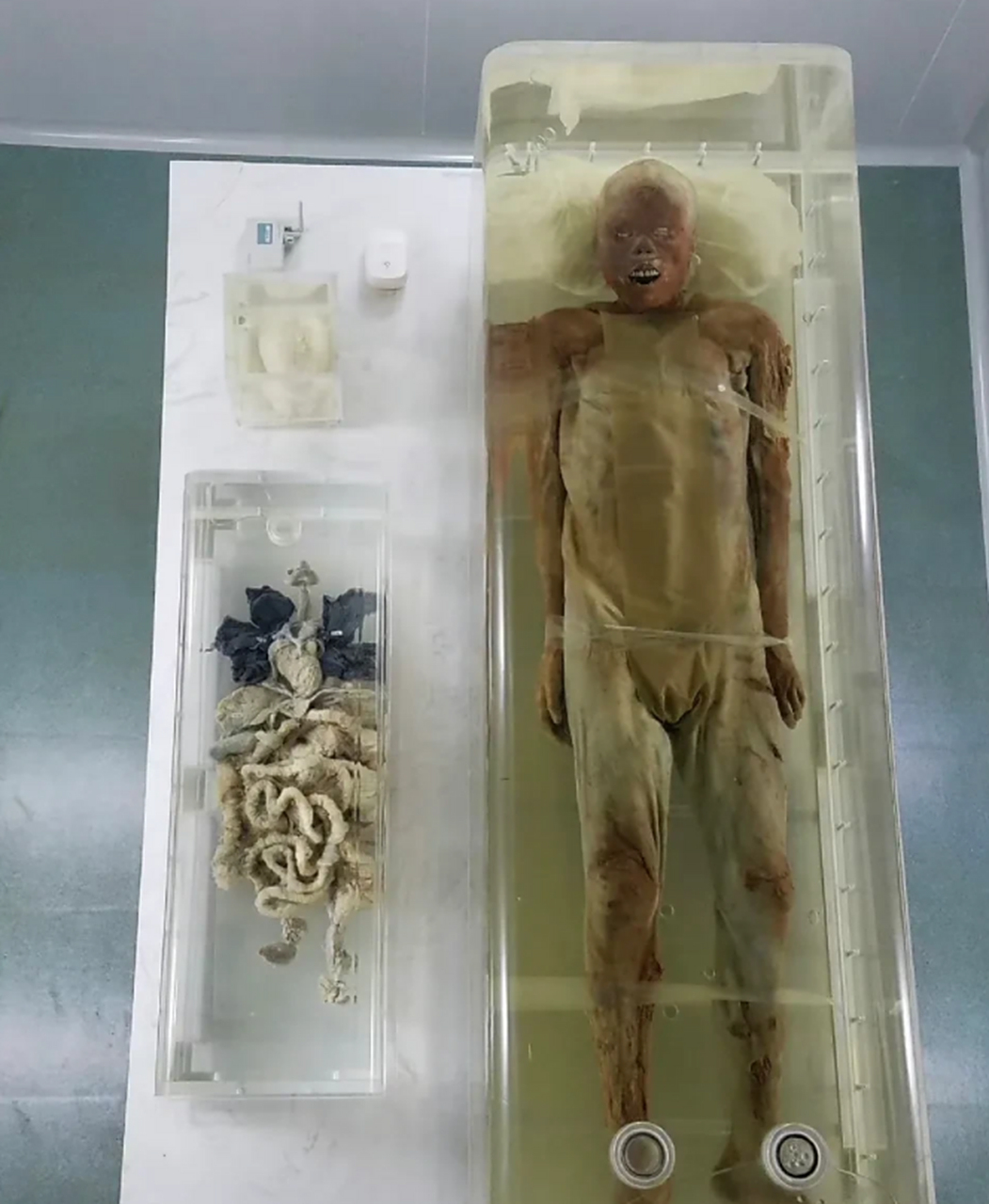 1975年,荆州凤凰山出土的西汉男尸,现在是荆州博物馆镇馆之宝,与长沙