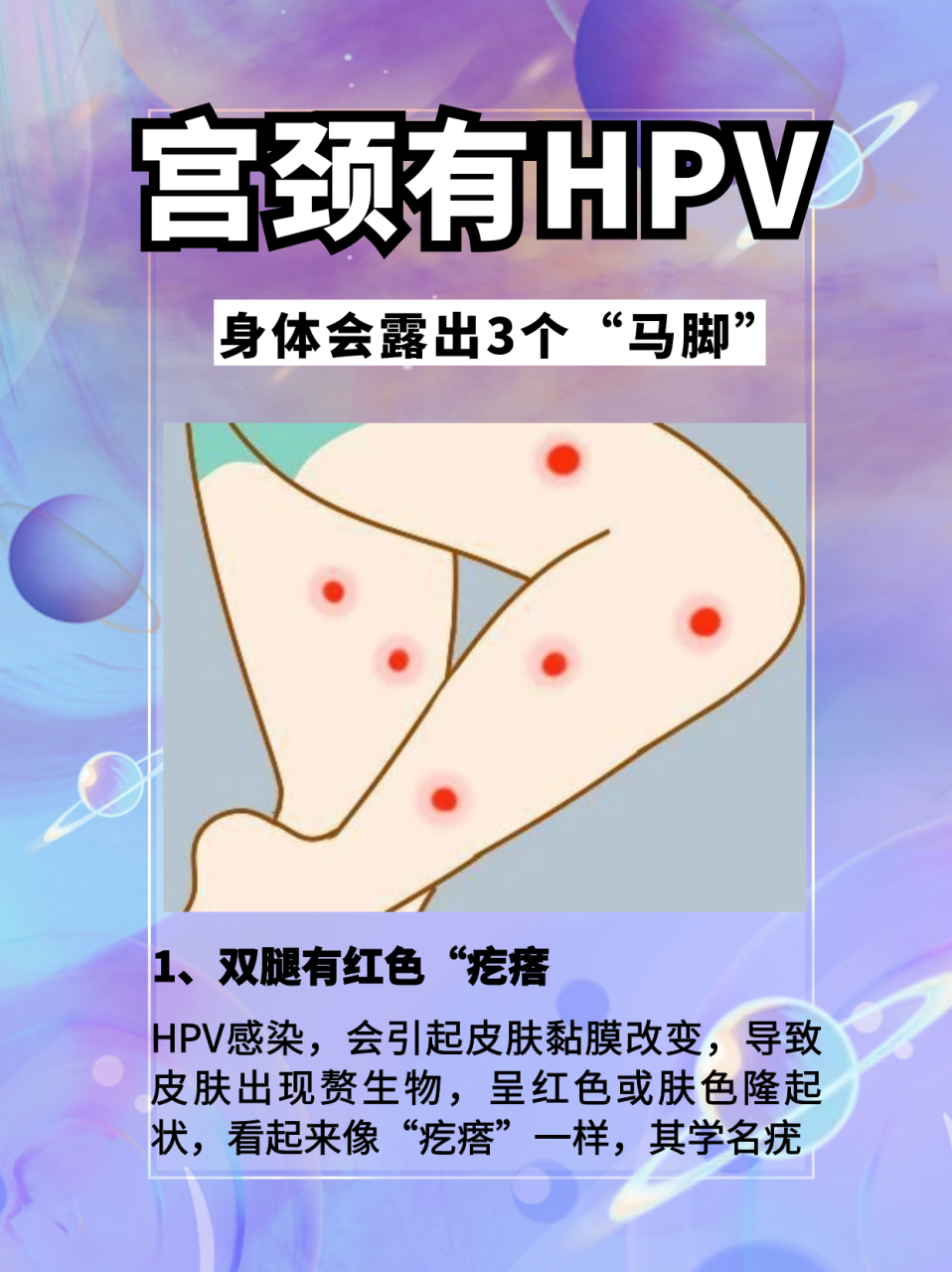 女性hpv真实图片 意思图片