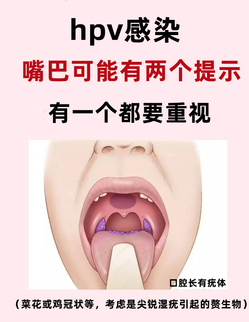 口腔hpv怎么治疗图片