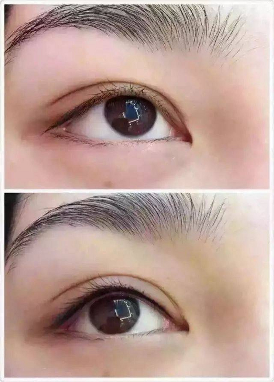 纹内眼线的疼痛感因个人敏感度而异,有些人可能会感觉到轻微的不适