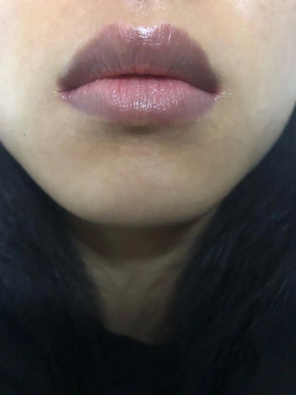 8215去角质 嘴角周围的皮肤很容易因为角质层过厚而