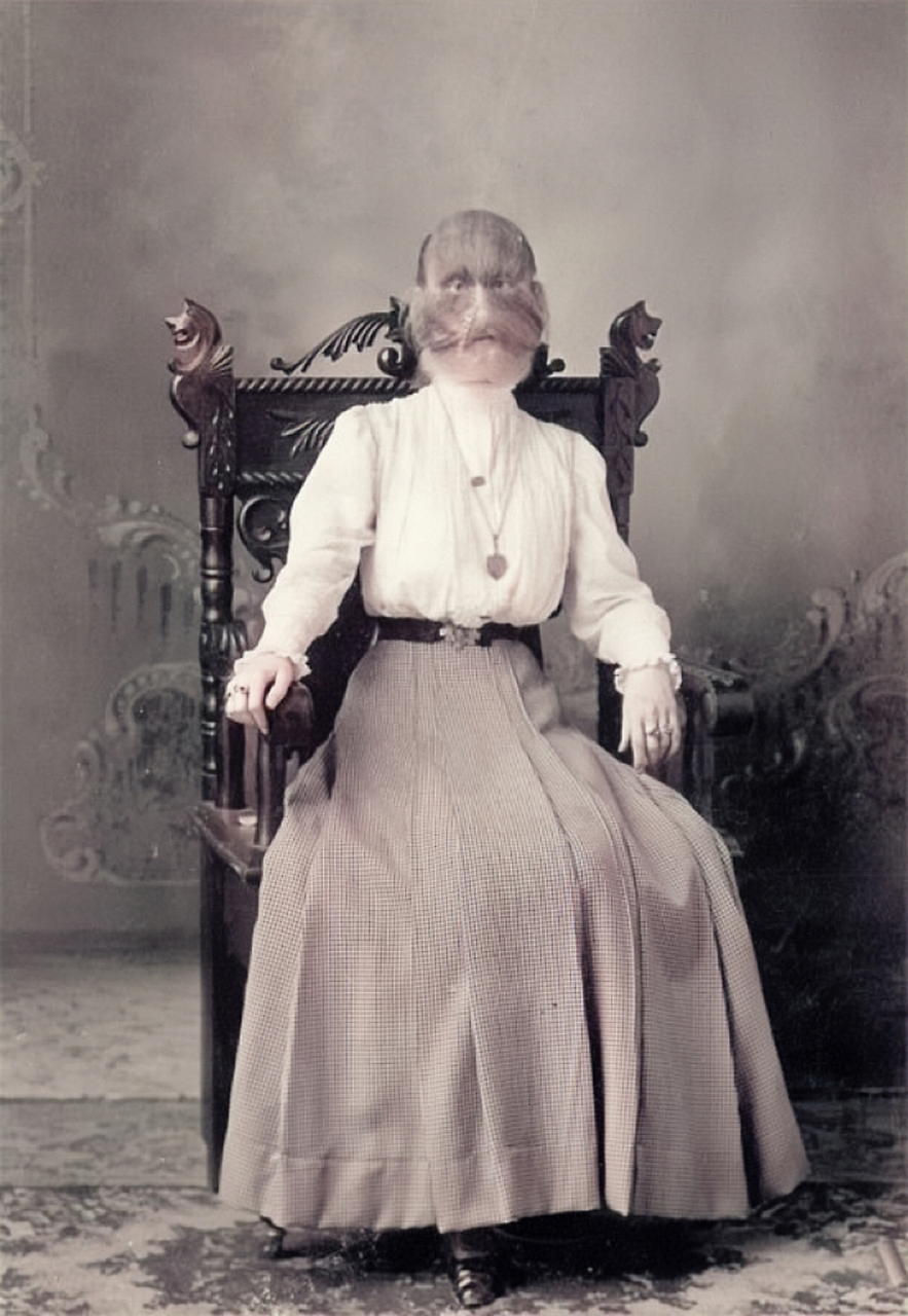 百年前,患有"多毛症"的美国女人.