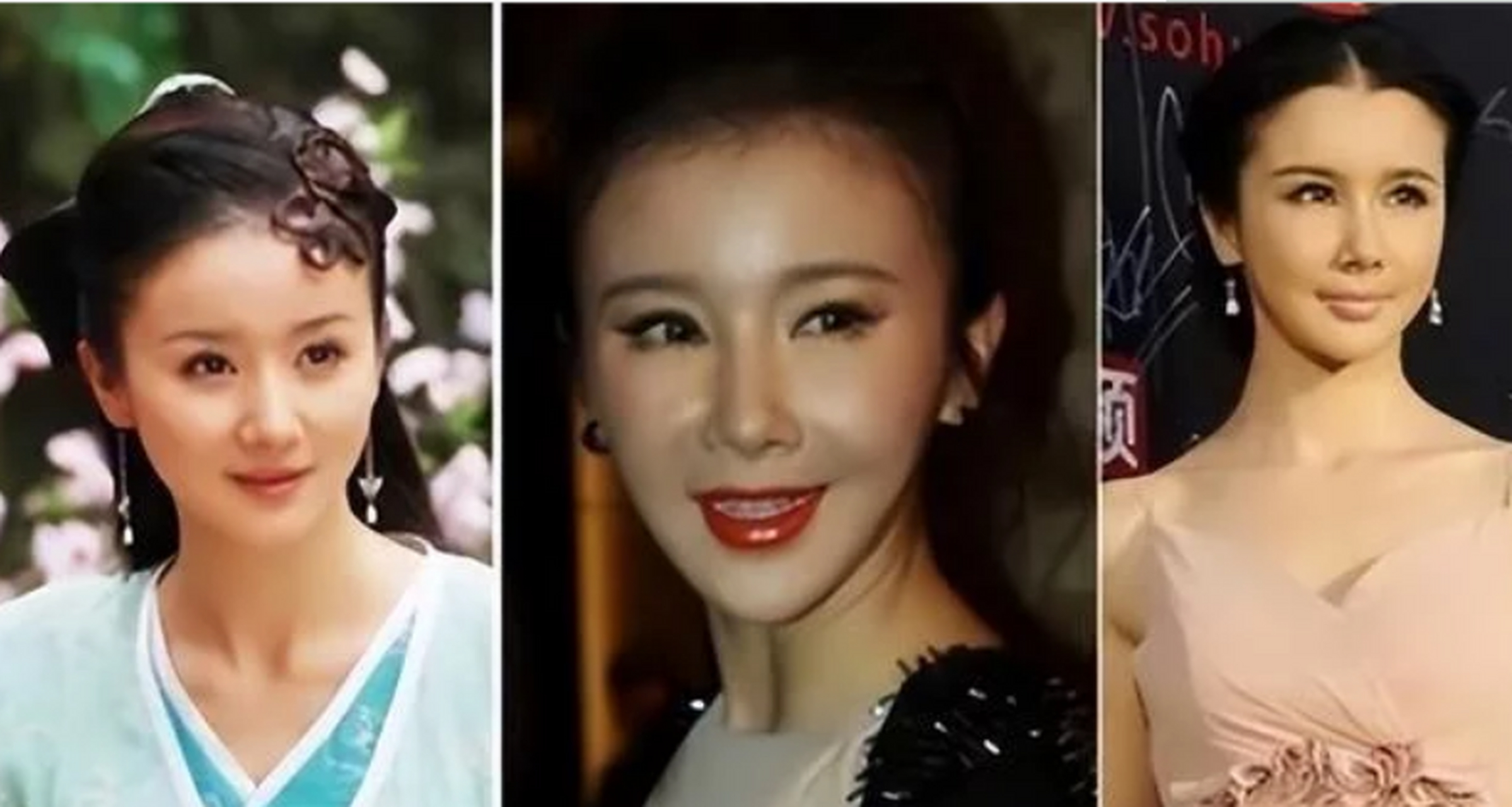 孙菲菲:曾经热衷于整容,被医美坑惨的她,现在终于清醒了