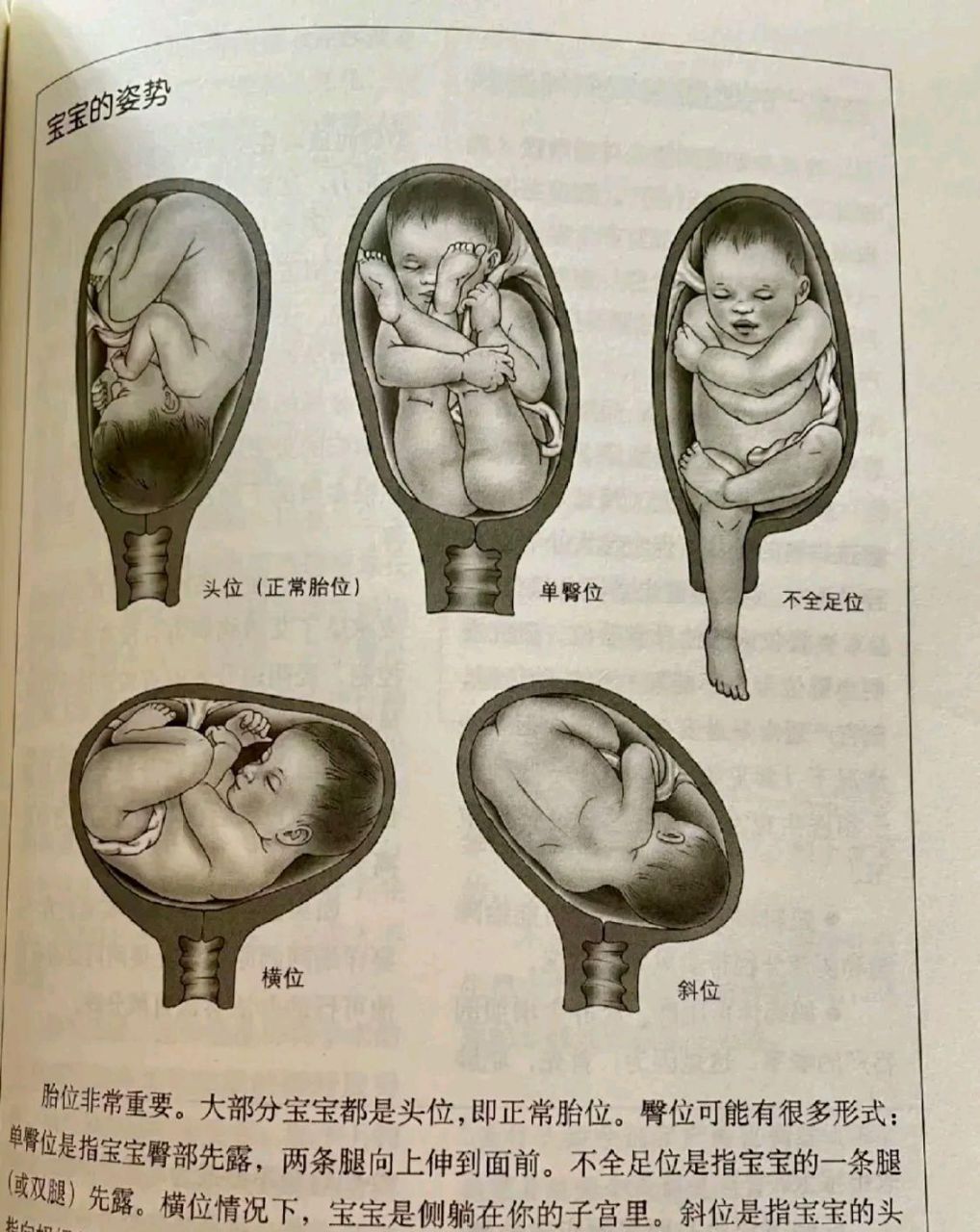 宝宝在妈妈肚子里的姿势,除了正常胎位,其他的真的让妈妈很辛苦呀