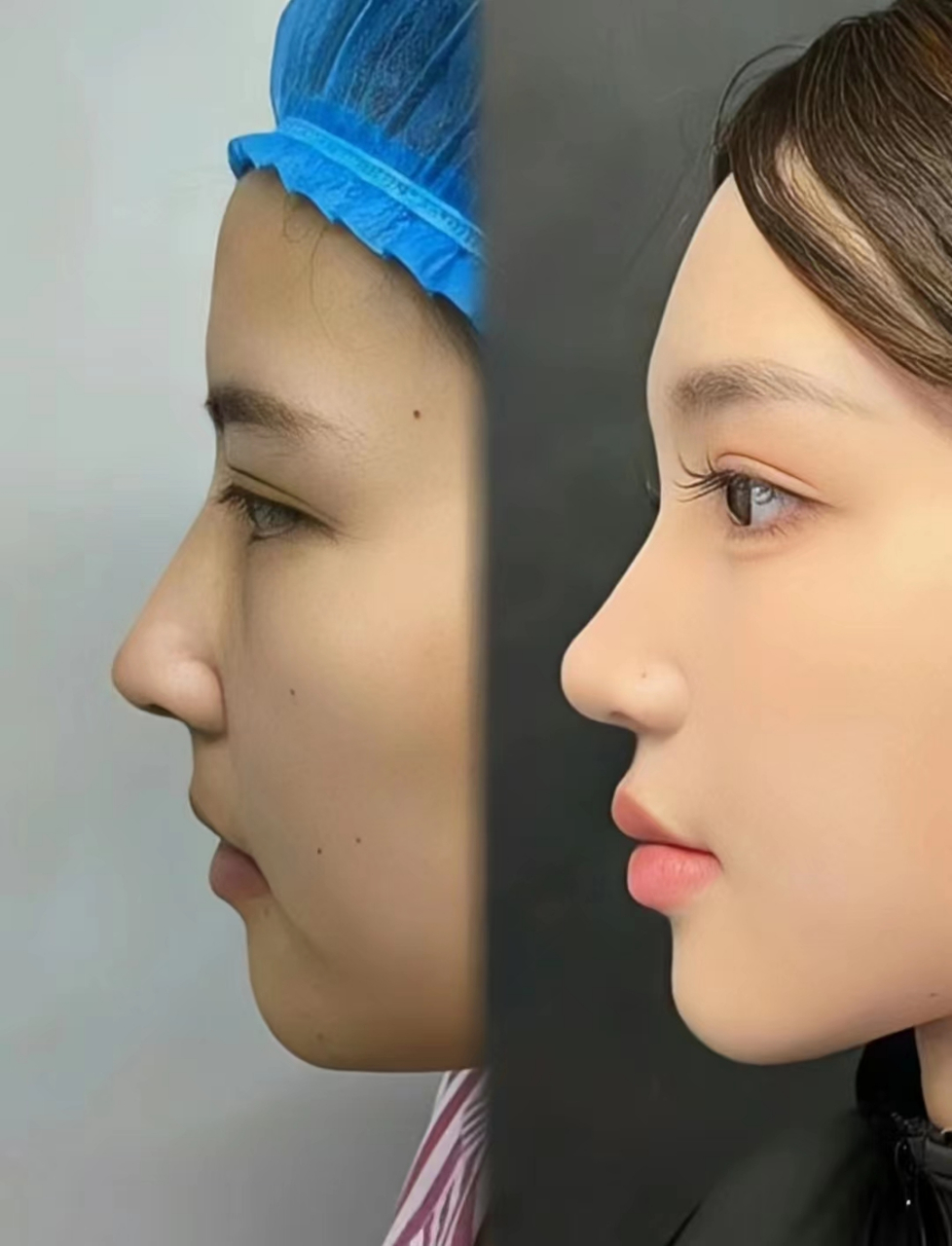 直鼻微翘才是真正大的鼻界天花板: 新鼻子真的好上镜,颜值狠狠那拿捏